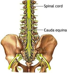 Horse Tails and Human Spines: Dr. McCormick’s Cauda Equina Surgery Video